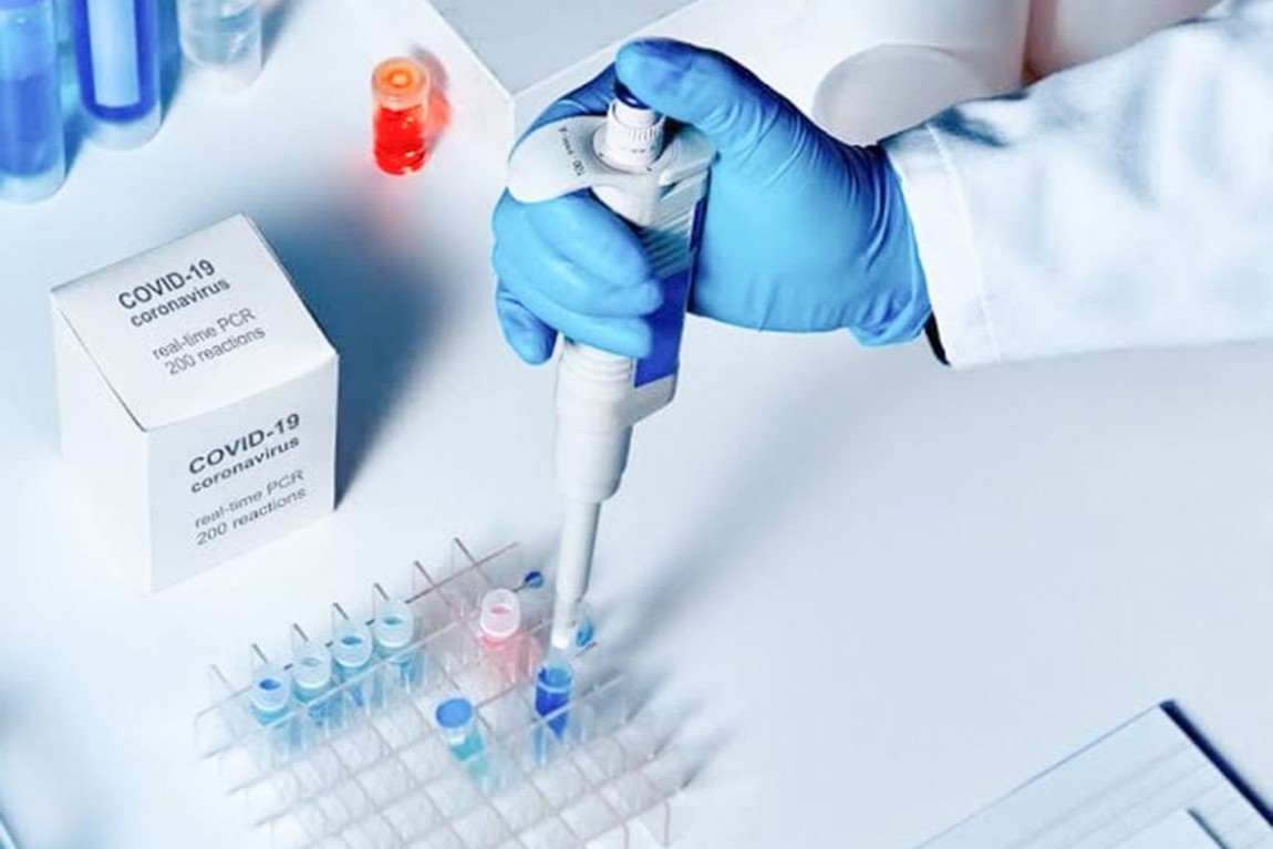 O MPSP sustentou a necessidade da manutenção da pesquisa RT PCR e da inclusão dos testes sorológicos no rol de procedimentos da ANS.